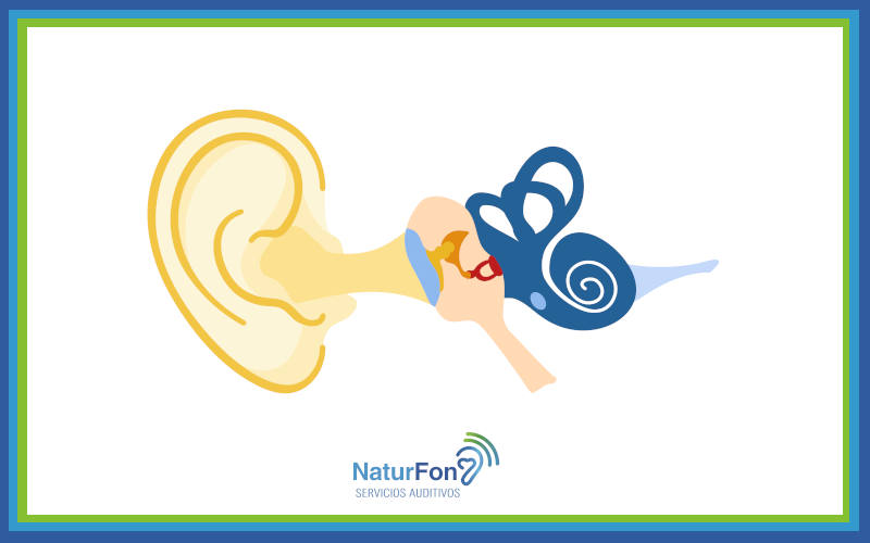 NaturFon responde a las preguntas sobre el Síndrome de Ménière